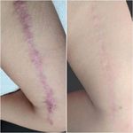 خدمات تخصصی تتو و کاموفلاژ بانوان- تارا