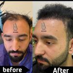 کلینیک کاشت مو سمیه فلاح