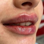 کلینیک زیبایی خانم محمدرضایی پوست ومو