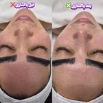 فیشال و پاکسازی تخصصی پوست سولماز