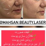 کلینیک لیزر و زیبایی مهسان