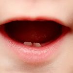 دندانپزشکی ژیلا نریمانی