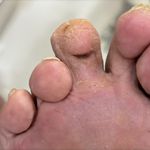 مهدی فتوحی درمان زخم پاکدشت ورامین قرچک