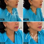کلینیک زیبایی و لیزر مو زائد نوبا