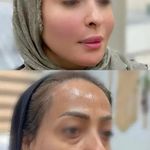 مرکز پوست و لیزر  سایناشور آمریکا دلدار