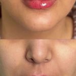 کلینیک ژل بوتاکس لیزر فیل بیوتی