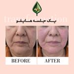 کلینیک زیبایی و مرکز لیزر آیه نقی زاده