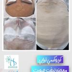 کلینیک پوست و مو و لیزر نیلوفر آبی