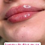 کلینیک زیبایی، لیزر و تخصصی زنان نفس