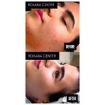 کلینیک پوست مو و زیبایی رکسانا