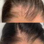 کلینیک پوست و مو و لیزر آتن