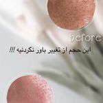 مرکز پاکسازی و پلاژن تراپی سیلکی فیشال