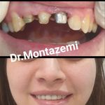 دندانپزشکی دکتر علی منتظمی (بیمه نداریم)