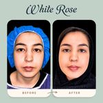 مرکز بلفاروپلاستی فوق تخصصی رز سفید