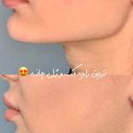 کلینیک تخصصی پوست و زیبایی ملینا