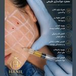 کلینیک هانیل | فیلر و بوتاکس شرق