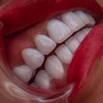کلینیک دندانپزشکی خاورمیانه نقد و اقساط