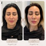 مطب زیبایی دکتر نلسا