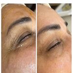 مرکز لاغری و پاکسازی پوست مانیا