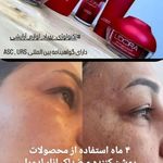 محصولات لدورا