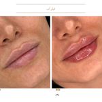 مرکز لیزر و کلینیک زیبایی دکتر با حجب