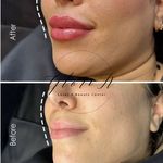 کلینیک زیبایی گلوریا