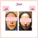 مرکز لیزر و کلینیک زیبایی بهاران