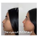 کلینیک زیبایی و لیزر مو زائد نوبا