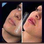 مطب پوست زيبايی ليزر دکتر شاه نعمت الهی