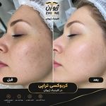 مرکز پی آر پی تهران