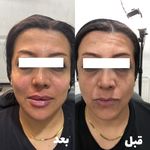 کلینیک پوست مو زیبایی و لیزر کهربا