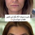 کلینیک پوست،مو،زیبایی،مرکز لیزر ‌پرنسا