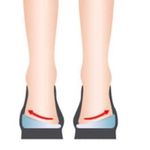 ارتوپدی فنی نبض حرکت، اسکن کف پا،کفی طبی