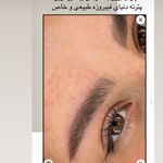 میکروپیگمنتیشن عارفه عارف نیا