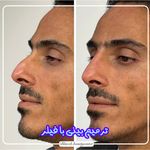 کلینیک پوست و مو بلانژ
