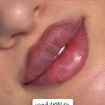 کلینیک زیبایی شایلی