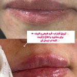 کلینیک زیبایی، لیزر و تخصصی زنان نفس