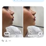 پوست مو زیبایی و لاغری دکتر درزی قائمشهر