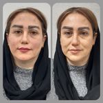 کلینیک لیزر و زیبایی مهرُنا