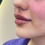 کلینیک زیبایی، پوست و لیزر(کندلا)  ظفر