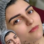 خدمات تخصصی میکروبلیدینگ  وریموو فرشته