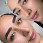 میکروبلیدینگ و فیبروز المیرا