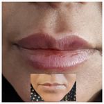 کلینیک زیبایی بوتاکس لیزر فیلر شجاعی