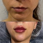 مطب پوست و زیبایی