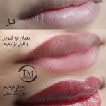 خدمات تخصصی آرایش دائم