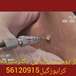 کلینیک پوست مو زیبایی لیزر دکتر شیرمحمدی