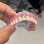 ساخت تخصصی دندان مصنوعی (ایران دنت)