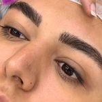 ریموو شیدینگ میکروبلیدینگ