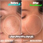 کلینیک پوست،مو،زیبایی،مرکز لیزر ‌پرنسا