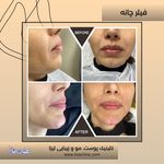مطب پوست مو زیبایی فردوس شرق
